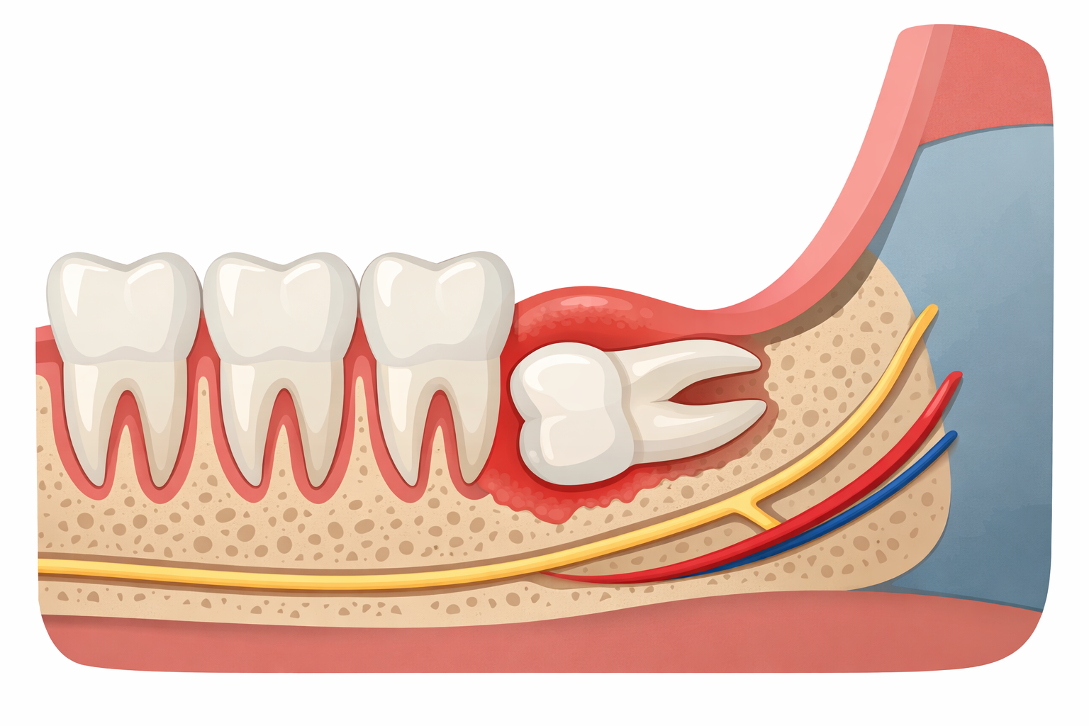 Featured image for Horizontal Wisdom Teeth: What It Means and Treatment Options