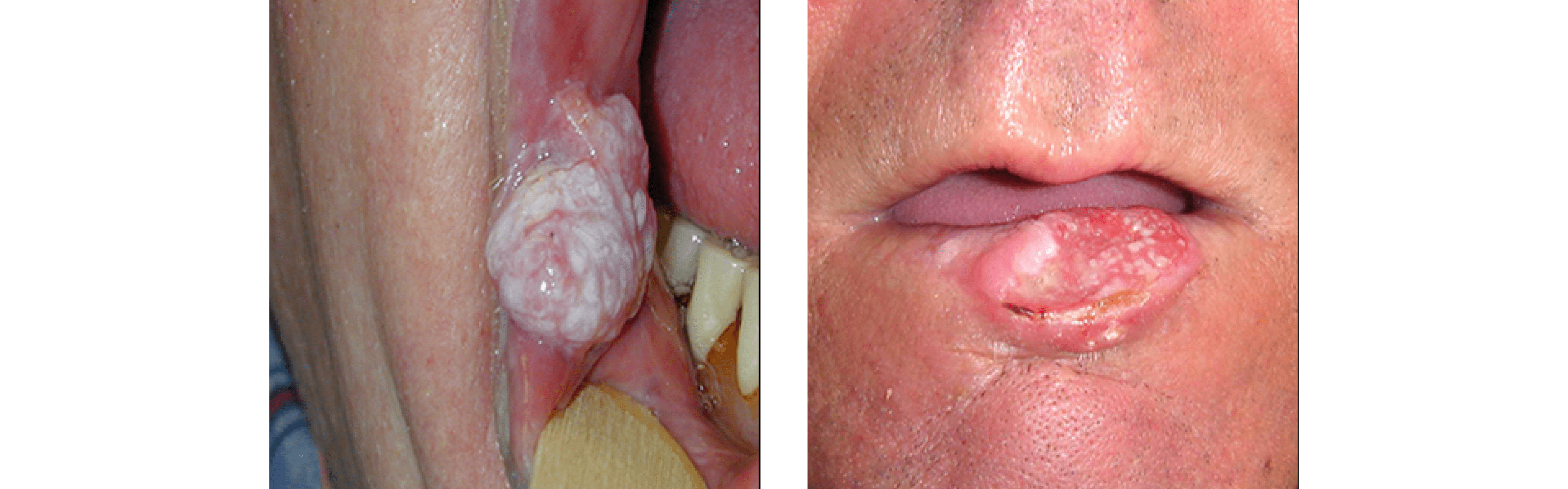 Oral Pathology Oral Pathology