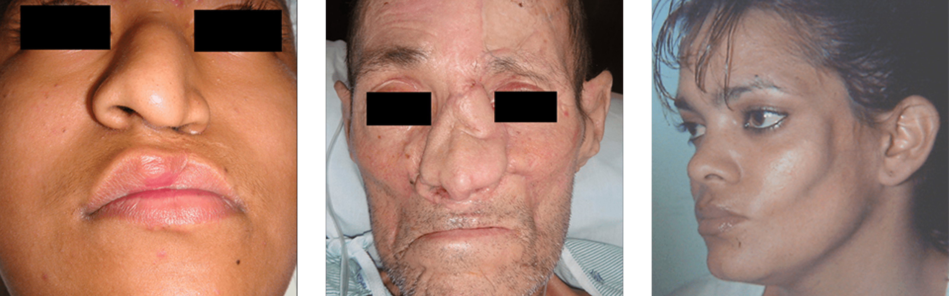Reconstructive Facial Surgery Reconstructive Facial Surgery