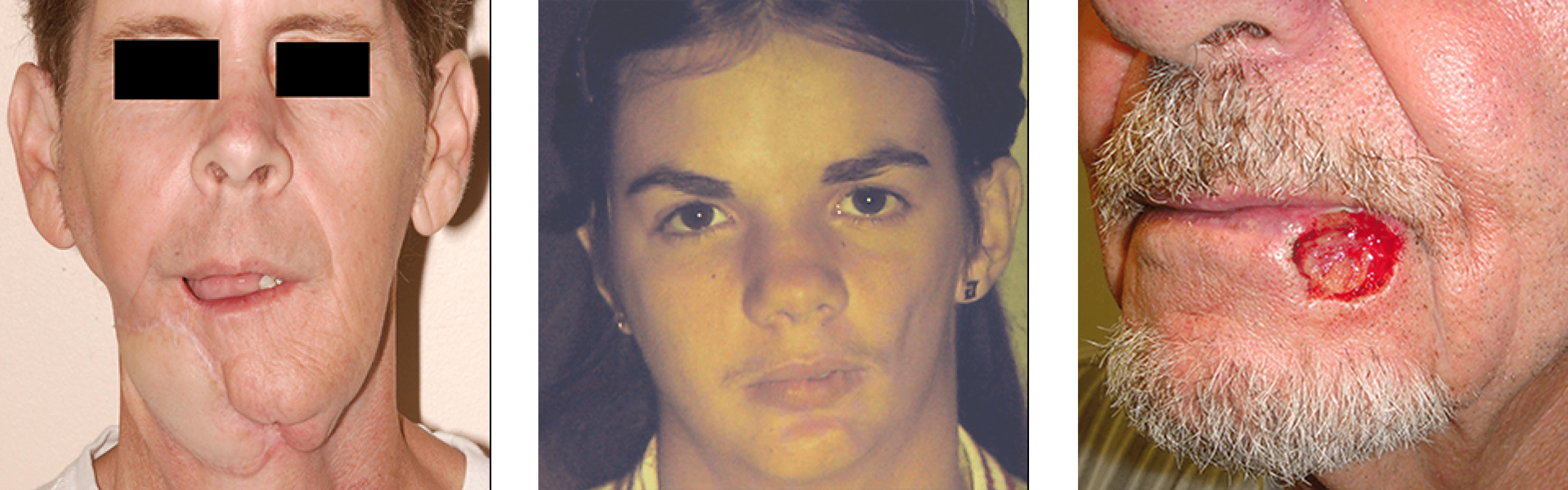 Reconstructive Facial Surgery Reconstructive Facial Surgery